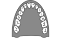Upper tooth model